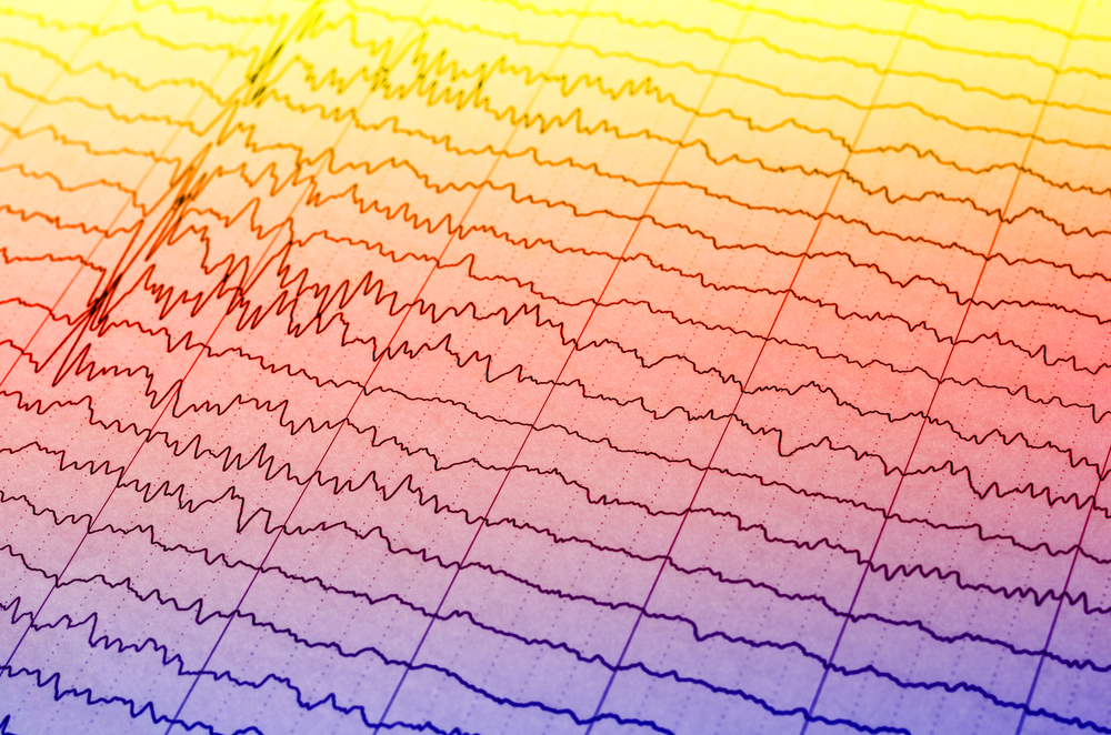 Spontaneous brain activity in infants.